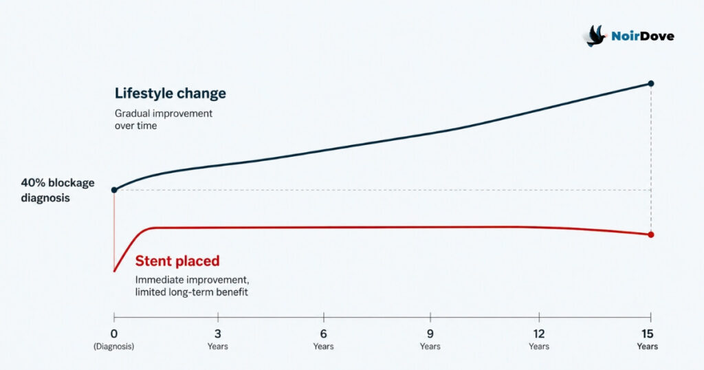 Minimalist editorial healthcare chart on an off-white background comparing two long-term treatment paths over 15 years. A navy line labeled “Lifestyle change” gradually rises upward over time, representing steady improvement. Below it, a muted red line labeled “Stent placed” rises sharply at the beginning, then remains mostly flat before slightly declining near the end, representing limited long-term benefit. Both lines begin from the same point labeled “40% blockage diagnosis.” A simple horizontal timeline at the bottom marks 0, 3, 6, 9, 12, and 15 years. The NoirDove logo appears in the top-right corner.